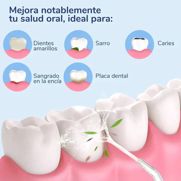 IRRIGADOR BUCAL -una Higiene Completa+ENVIO GRATIS⭐⭐⭐⭐⭐