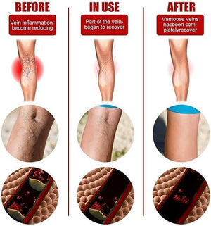 2 paq de 12 Parches para  arañitas _Venas inflamadas/ con ENVÍO GRATIS ⭐⭐⭐⭐⭐