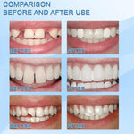 2 x 1 Reparación/ relleno  de dientes  temporal con ENVÍO GRATIS ⭐⭐⭐⭐⭐