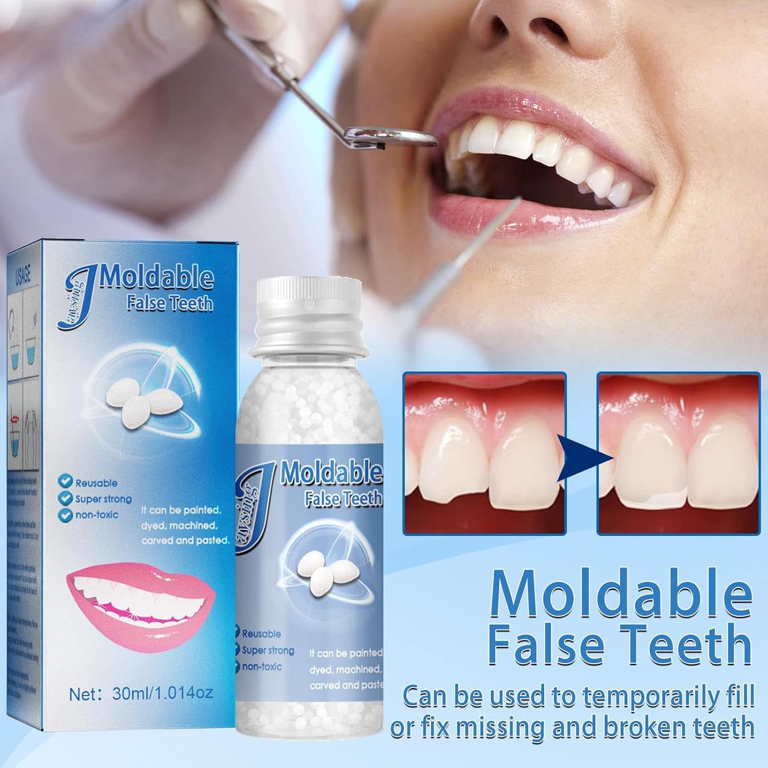 2 x 1 Reparación/ relleno  de dientes  temporal con ENVÍO GRATIS ⭐⭐⭐⭐⭐