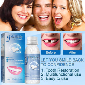 2 x 1 Reparación/ relleno  de dientes  temporal con ENVÍO GRATIS ⭐⭐⭐⭐⭐
