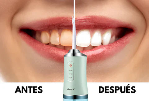 IRRIGADOR BUCAL -una Higiene Completa+ENVIO GRATIS⭐⭐⭐⭐⭐