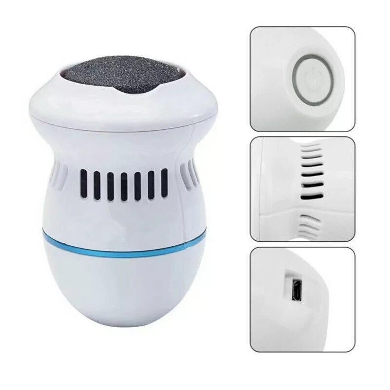 Removedor De Callos E Impurezas Recargable +ENVÍO GRATIS⭐⭐⭐⭐⭐